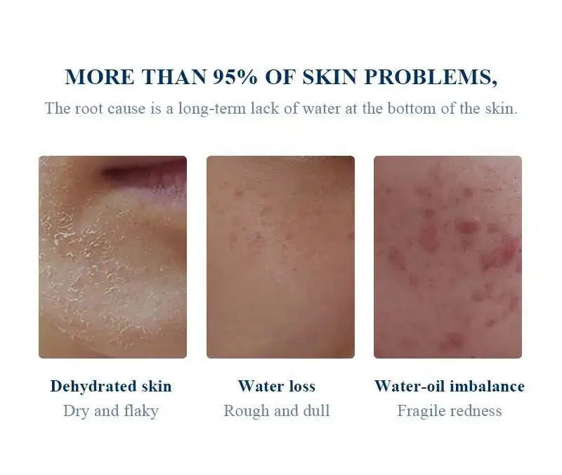 BELYN BERLY Hyaluronic Acid Face Serum 3PCS Hydrating and Moisturizing Facial Serum Skin Care Products